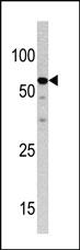 Anti-NCAPH2 Rabbit Polyclonal Antibody