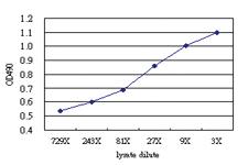 Anti-PRKAB1 Antibody Pair