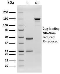 SDS-PAGE analysis of Anti-CD79b Antibody [rIGB/1842] under non-reduced and reduced conditions; showing intact IgG and intact heavy and light chains, respectively. SDS-PAGE analysis confirms the integrity and purity of the Antibody