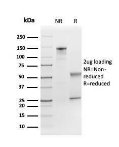 SDS-PAGE analysis of Anti-FGF21 Antibody [FGF21/3691] under non-reduced and reduced conditions; showing intact IgG and intact heavy and light chains, respectively. SDS-PAGE analysis confirms the integrity and purity of the antibody