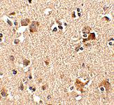 Anti-AIPL1 Rabbit Polyclonal Antibody