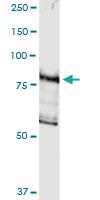 Anti-DGKG Polyclonal Antibody Pair