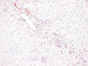 Immunohistochemical analysis of paraffin-embedded human Liver using Anti-CD34 Antibody