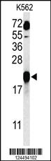 Anti-GAGE7 Rabbit Polyclonal Antibody