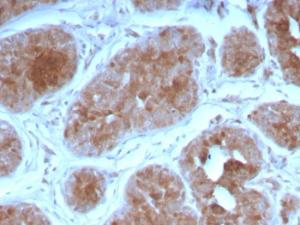 Immunohistochemical analysis of formalin-fixed, paraffin-embedded human breast using Anti-FGF21 Antibody [FGF21/3691]