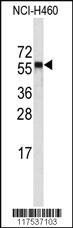 Anti-CYP4A11 (4A22) Rabbit Polyclonal Antibody