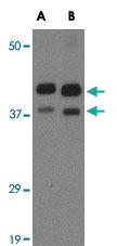 Anti-AIPL1 Rabbit Polyclonal Antibody