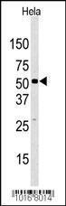 Anti-KDM4D Rabbit Polyclonal Antibody (Biotin)