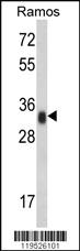 Anti-HLA-DRA Rabbit Polyclonal Antibody