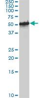 Anti-FOXA1 Mouse Monoclonal Antibody [clone: 3C1]