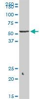 Anti-KLF10 Mouse Monoclonal Antibody [clone: 2E7]