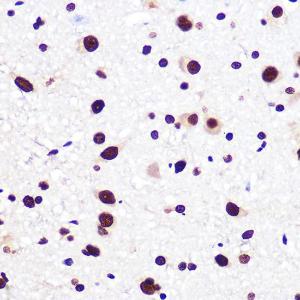 Immunohistochemistry analysis of paraffin-embedded rat brain using Anti-SAM68 Antibody [ARC0858] (A307676) at a dilution of 1:100 (40x lens) Perform microwave antigen retrieval with 10 mM PBS buffer pH 72 before commencing with IHC staining protocol