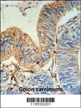 Anti-DTX3 Rabbit Polyclonal Antibody