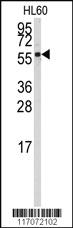 Anti-CYP4Z1 Rabbit Polyclonal Antibody