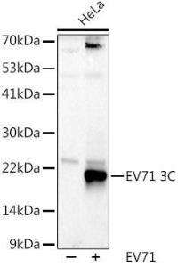 Western blot analysis of extracts of HeLa cells, using Anti-Enterovirus 71 3D Antibody (A309771) at 1:1,000 dilution