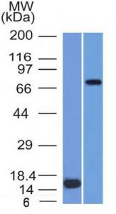 Western blot analysis of (Lane 1) recombinant MMP2 protein and (Lane 2) U87 cell lysate using Anti-MMP2 Antibody [MMP2/1501]