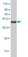 Anti-DKK1 Mouse Monoclonal Antibody [clone: 1F5]