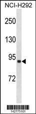 Anti-ACSL1 Rabbit Polyclonal Antibody (Biotin)