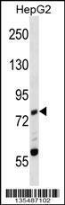 Anti-ZAP70 Rabbit Polyclonal Antibody