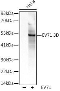 Western blot analysis of extracts of HeLa cells, using Anti-Enterovirus 71 3D Antibody (A309772) at 1:1,000 dilution