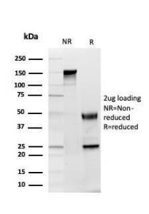 SDS-PAGE analysis of Anti-GDF8 Antibody [GDF9/4261] under non-reduced and reduced conditions; showing intact IgG and intact heavy and light chains, respectively. SDS-PAGE analysis confirms the integrity and purity of the antibody