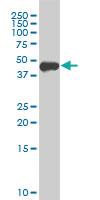 Anti-FOXA1 Mouse Monoclonal Antibody [clone: 3C1]