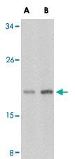 Anti-IL17A Rabbit Polyclonal Antibody