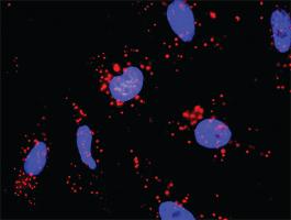 Anti-AKT1 + EIF4EBP1 Antibody Pair