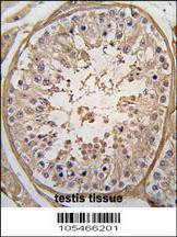 Anti-PGK2 Rabbit Polyclonal Antibody (HRP (Horseradish Peroxidase))