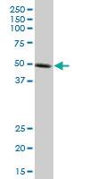 Anti-KLF10 Mouse Monoclonal Antibody [clone: 2E7]