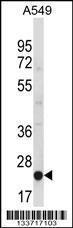 Anti-MBL2 Rabbit Polyclonal Antibody (Biotin)