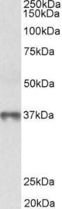 Anti-MAT2B Antibody (A82578) (0.3 µg/ml) staining of Human Thymus lysate (35 µg protein in RIPA buffer). Primary incubation was 1 hour. Detected by chemilu minescence