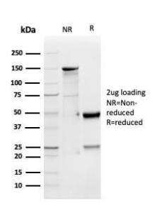 SDS-PAGE analysis of Anti-GDF9 Antibody [GDF9/4261] under non-reduced and reduced conditions; showing intact IgG and intact heavy and light chains, respectively. SDS-PAGE analysis confirms the integrity and purity of the antibody