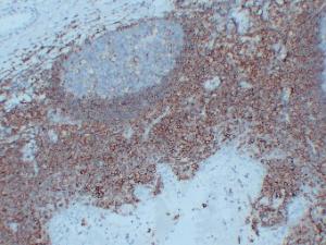 Immunohistochemical analysis of paraffin-embedded human Tonsil using Anti-CD44 Antibody