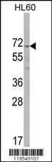 Anti-ALKBH8 Rabbit Polyclonal Antibody