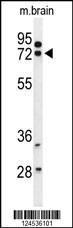 Anti-HSPA12A Rabbit Polyclonal Antibody (Biotin)