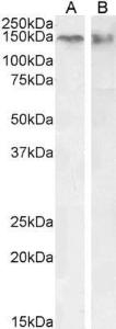 Anti-CTCF antibody