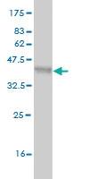 Anti-DKK1 Mouse Monoclonal Antibody [clone: 4C10]