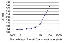 Anti-TP53RK Mouse Monoclonal Antibody (Biotin)