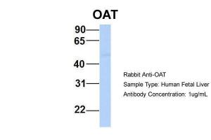 Anti-OAT Rabbit Polyclonal Antibody