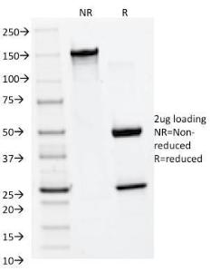 SDS-PAGE analysis of Anti-MMP2 Antibody [MMP2/1501] under non-reduced and reduced conditions; showing intact IgG and intact heavy and light chains, respectively. SDS-PAGE analysis confirms the integrity and purity of the antibody