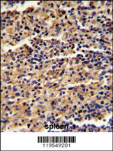 Anti-ALKBH8 Rabbit Polyclonal Antibody