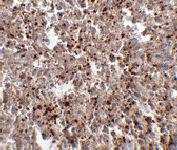 Anti-METTL7B Rabbit Polyclonal Antibody