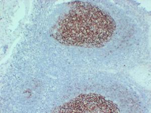 Immunohistochemical analysis of paraffin-embedded human Tonsil using Anti-CD23 Antibody