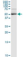 Anti-DBT Rabbit Polyclonal Antibody