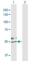 Anti-DBT Rabbit Polyclonal Antibody