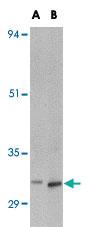 Anti-METTL7B Rabbit Polyclonal Antibody