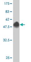 Anti-DKK1 Mouse Monoclonal Antibody [clone: 4B10]