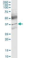 Anti-ACVR2B Polyclonal Antibody Pair