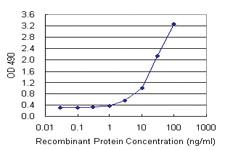 Anti-TP53RK Mouse Monoclonal Antibody (Biotin)